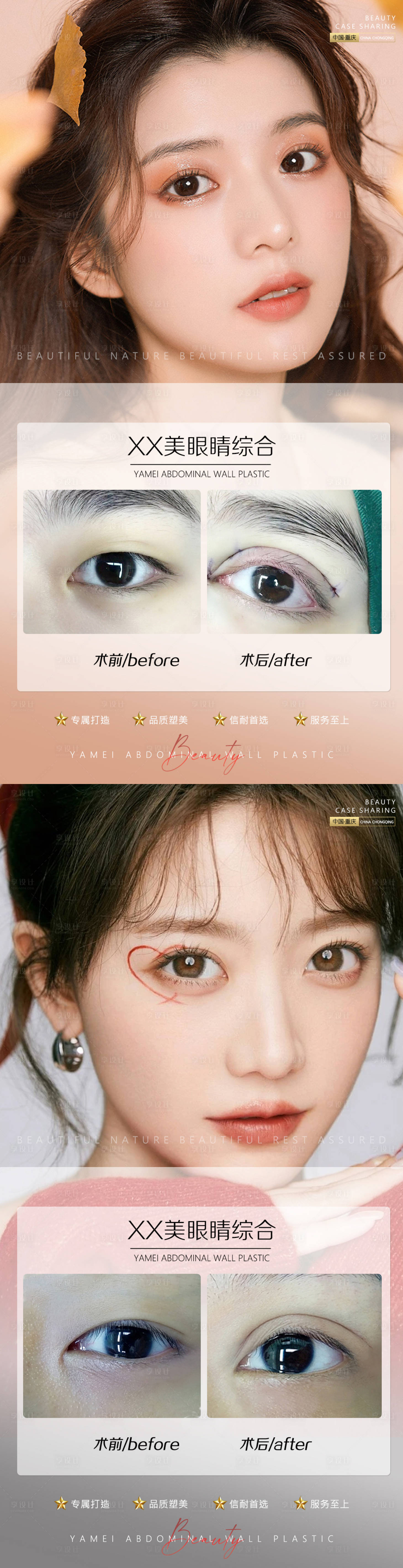 源文件下载【享设计】搜索编号：29860011117153728【医美案例眼睛】