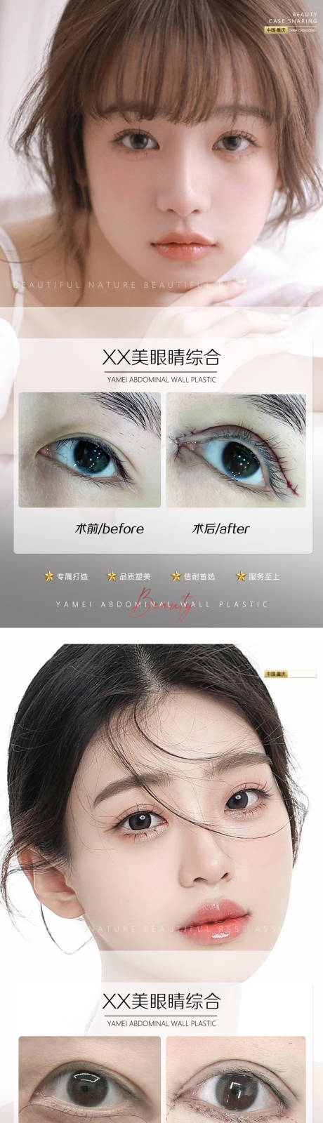 源文件下载【医美案例眼睛】编号：32120011159803734