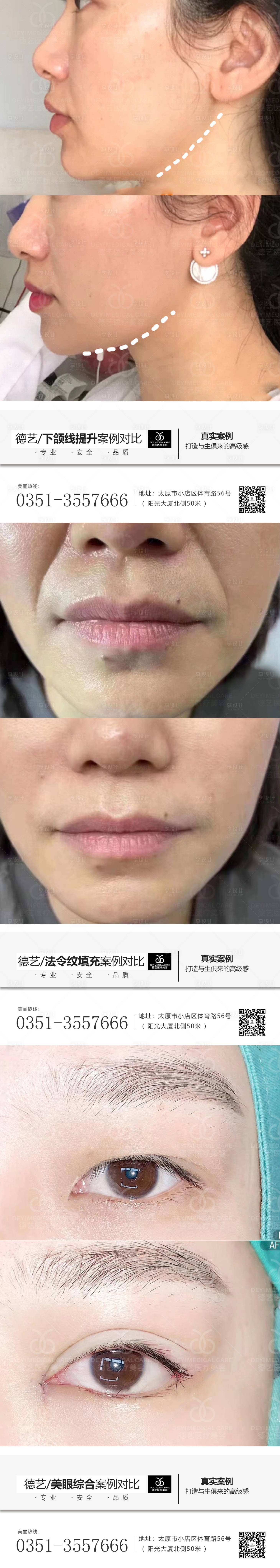 源文件下载【医美案例对比人物系列海报】编号：83050011224949516