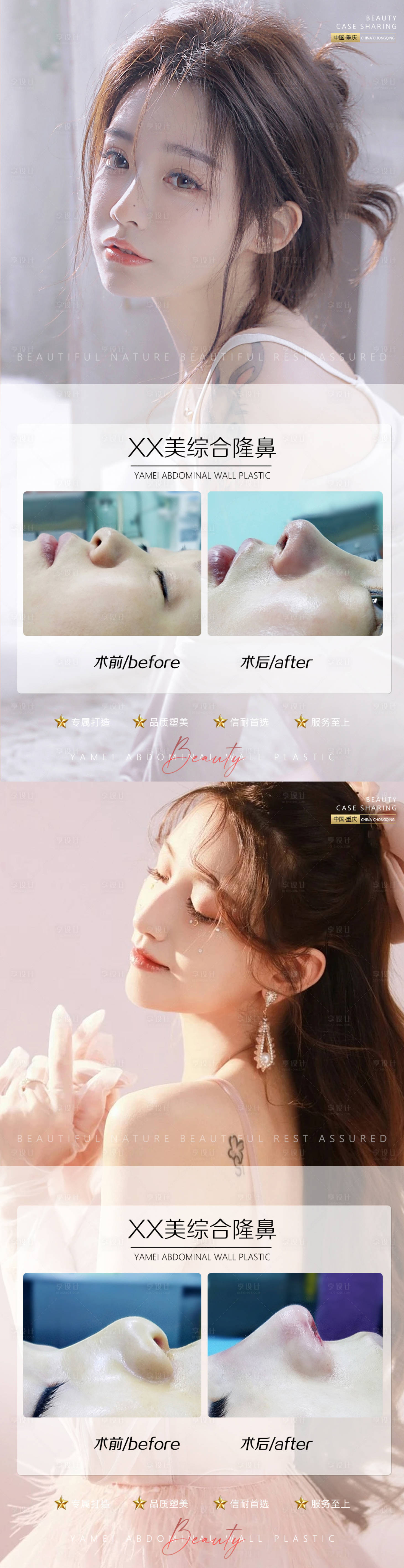 源文件下载【医美案例鼻子系列海报】编号：27060011135868899
