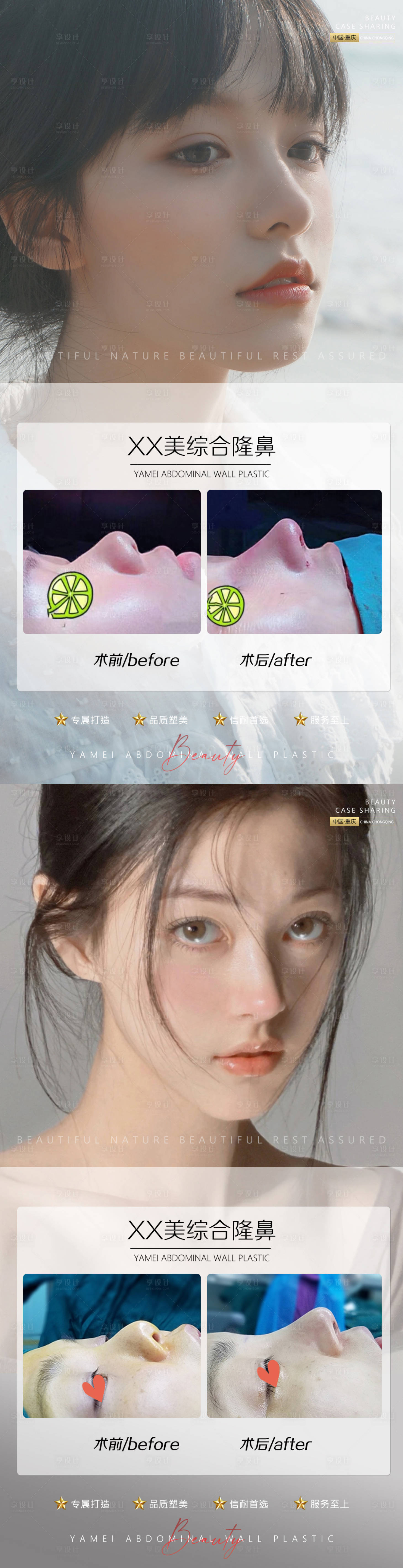 源文件下載【享設計】搜索編號：89700011116021913【醫美案例鼻子】
