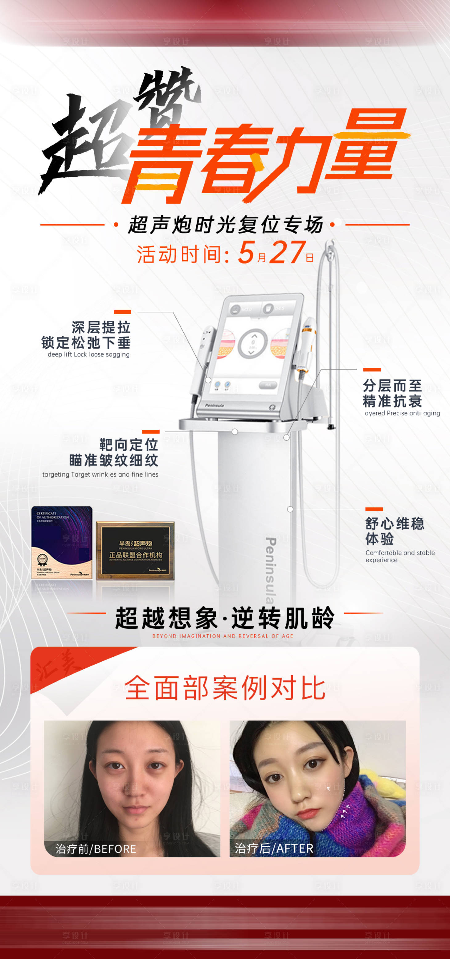 源文件下載【享設(shè)計】搜索編號：73220011017266510【醫(yī)美儀器海報 】