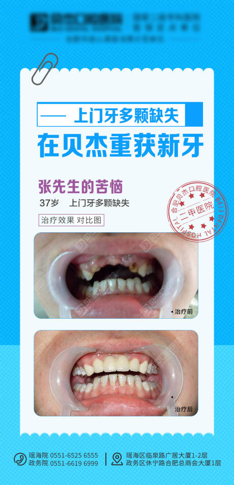 源文件下载【张先生的苦恼门牙缺失】编号：85160010950893907