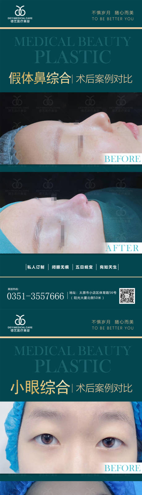 源文件下载【医美案例对比图】编号：36540011362747157