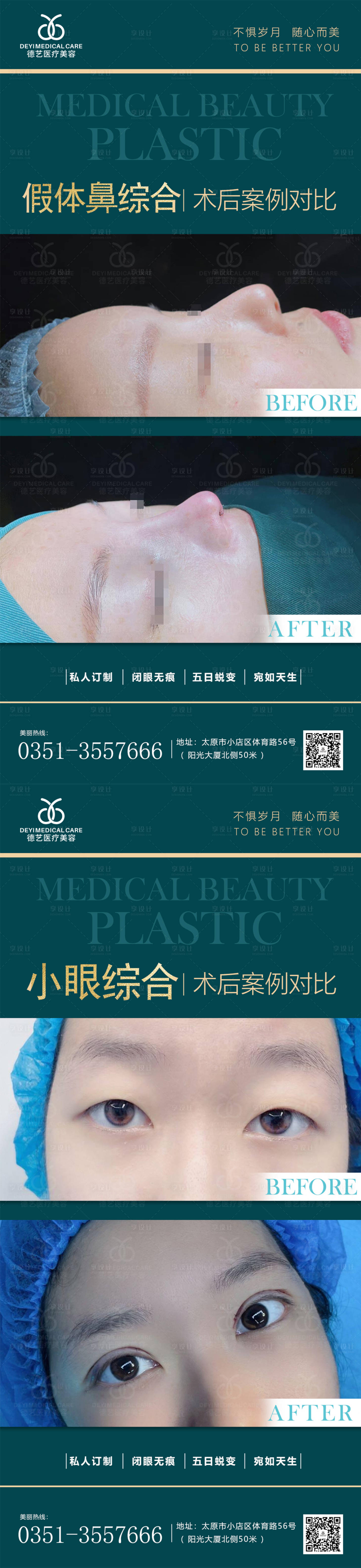 源文件下载【享设计】搜索编号：36540011362747157【医美案例对比图】