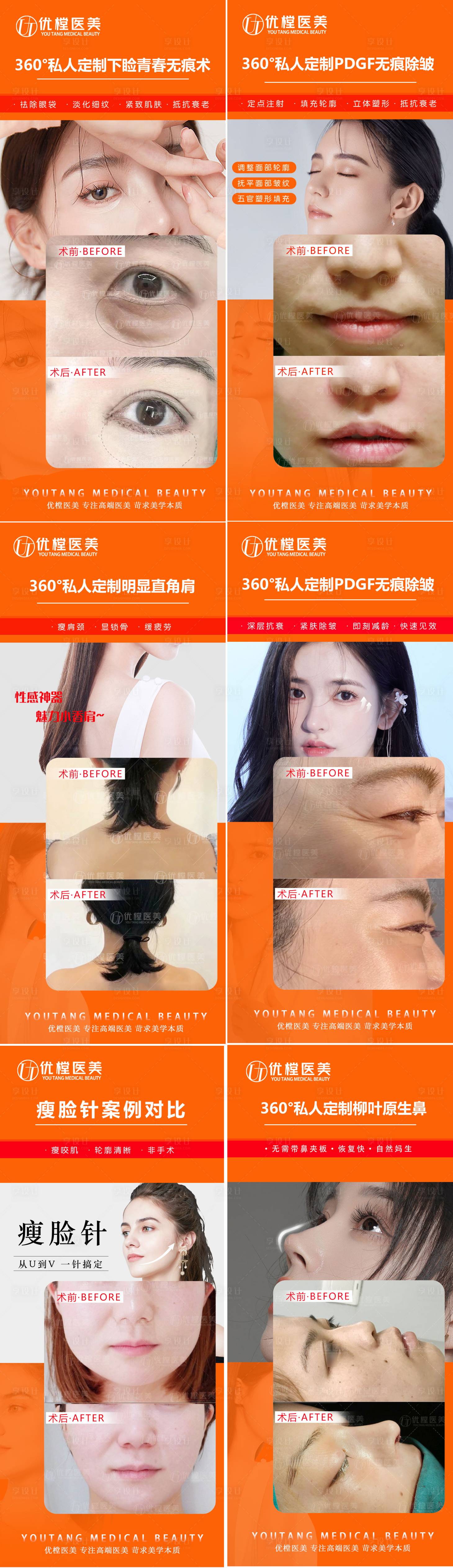 源文件下载【医美案例对比海报】编号：59450010906115871