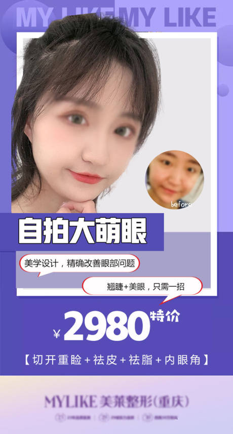 源文件下载【自拍大萌眼医美人物海报】编号：87190011110241200