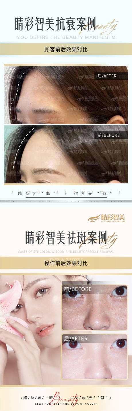 源文件下载【抗衰案例对比海报】编号：89900010852096595