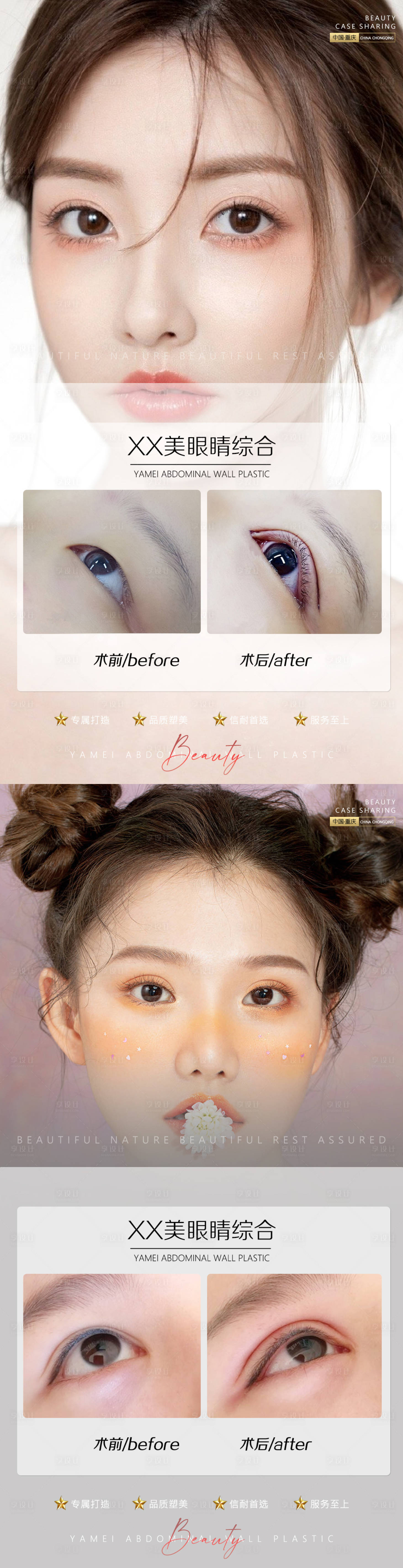 源文件下載【享設(shè)計(jì)】搜索編號(hào)：49080011264152769【醫(yī)美案例眼睛海報(bào)】