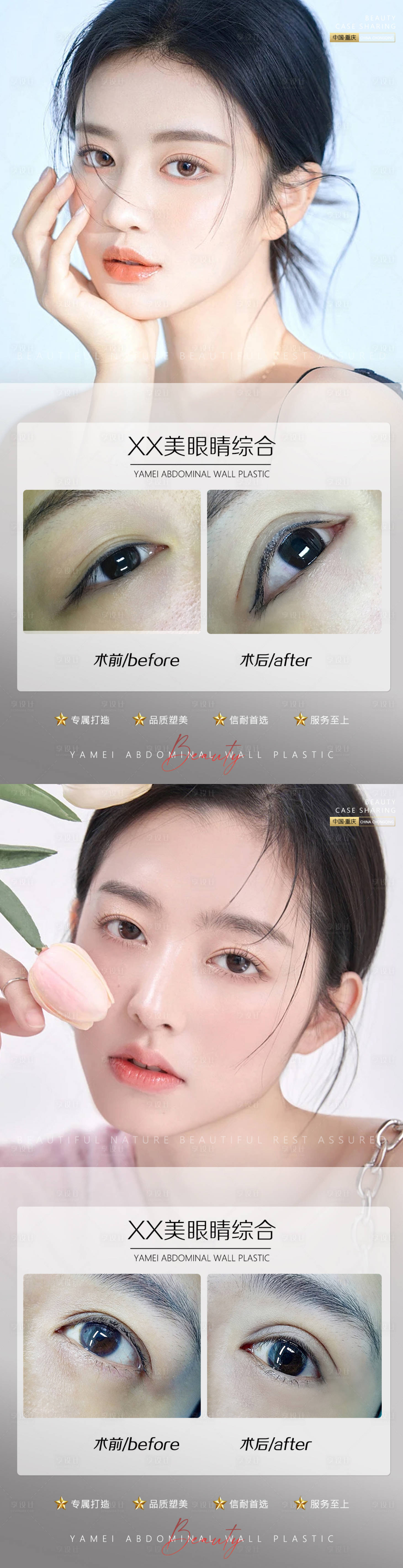 源文件下載【享設計】搜索編號：80570011096727953【醫美案例眼睛系列海報】