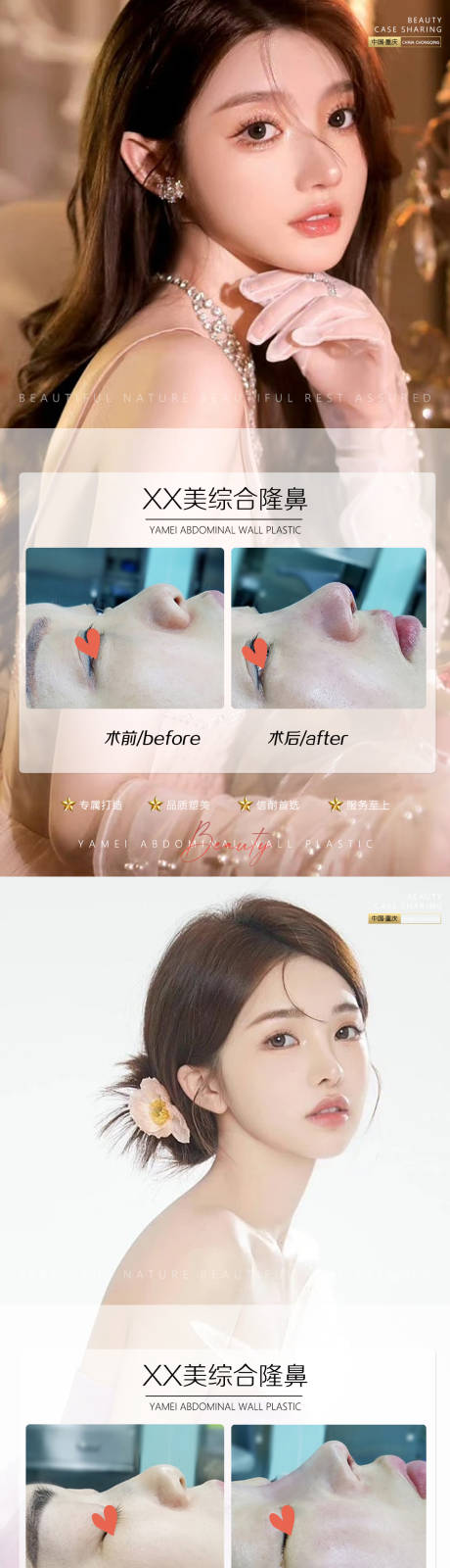 源文件下载【医美案例】编号：49080011335133906