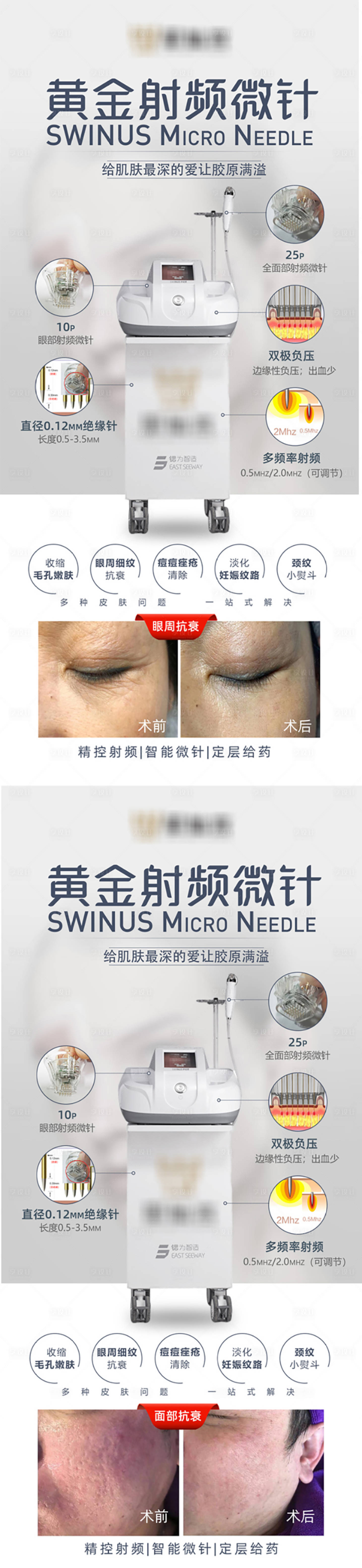 源文件下載【享設(shè)計】搜索編號：19200010836749935【光電黃金射頻微針海報】