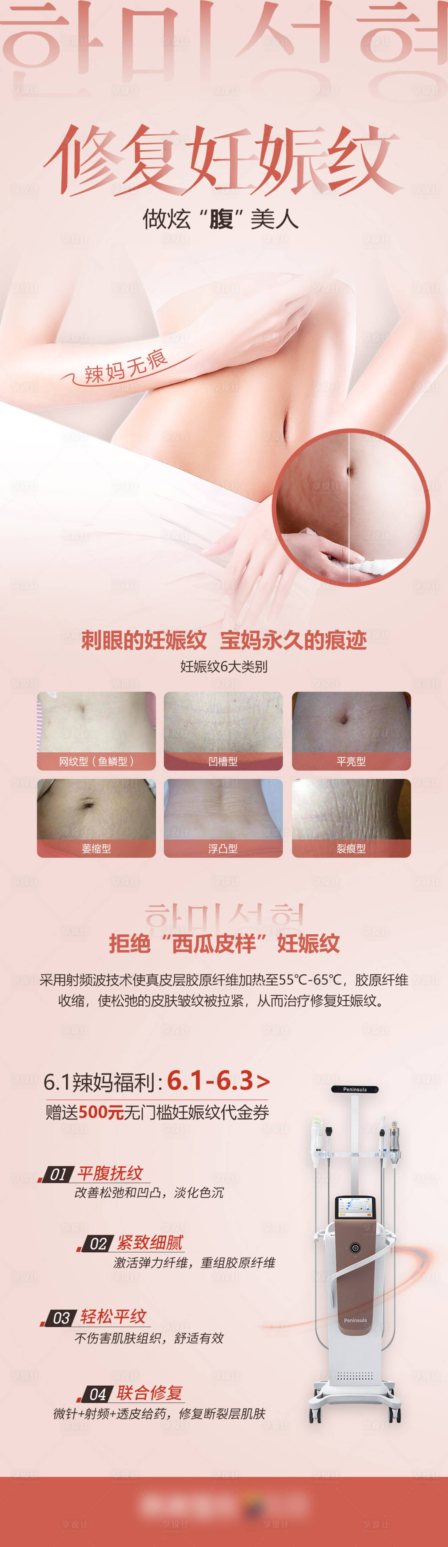 源文件下载【享设计】搜索编号：91410010961089377【医学整形美容修复妊娠纹介绍详情】