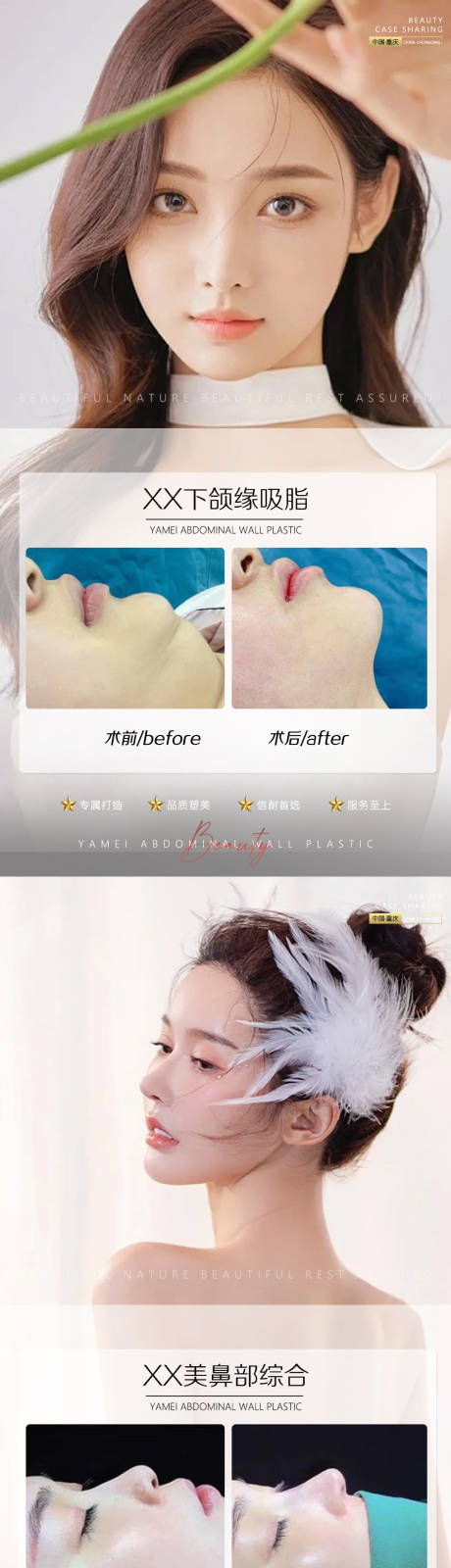 源文件下载【医美案例鼻子下颌缘吸脂】编号：81740011007487557