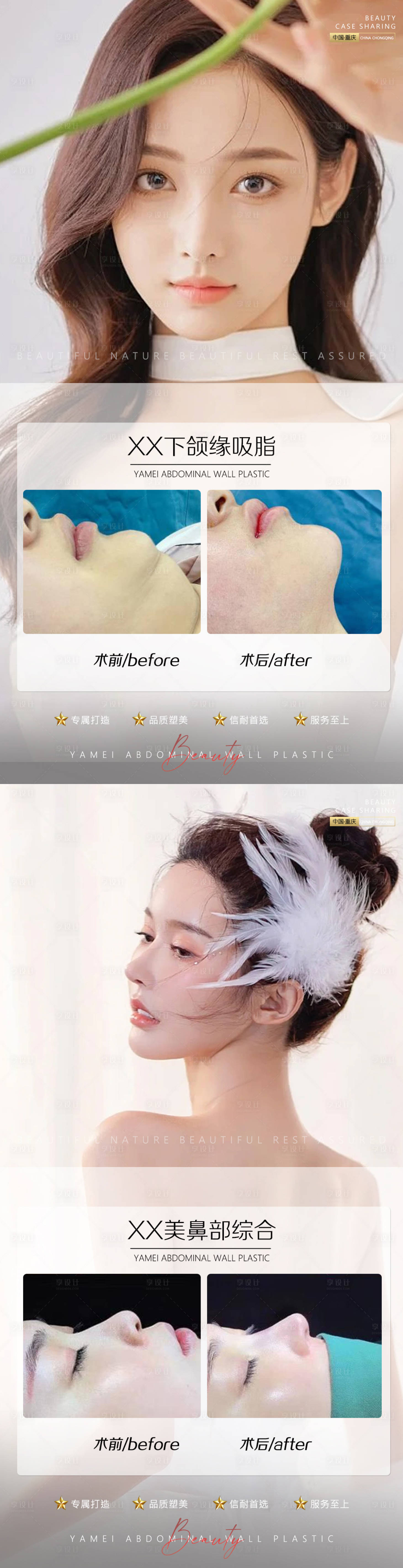 源文件下載【享設計】搜索編號：81740011007487557【醫(yī)美案例鼻子下頜緣吸脂】