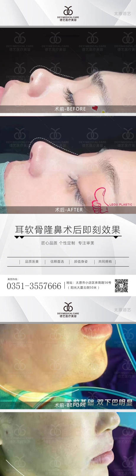 源文件下载【医美案例对比图】编号：14790011075587179