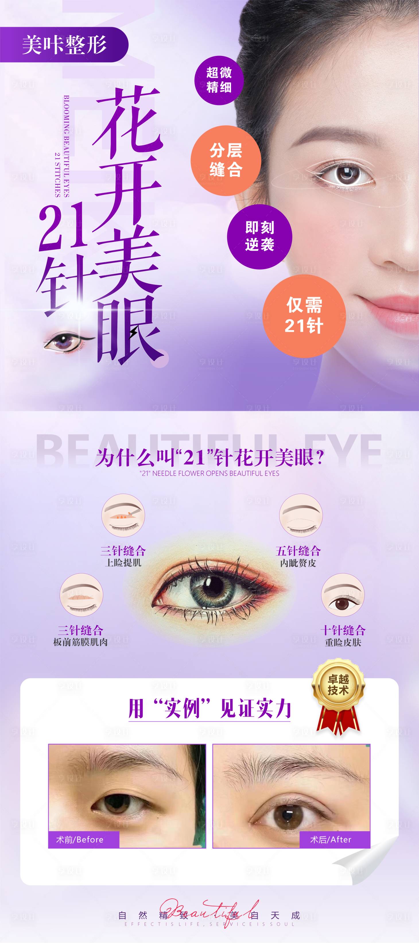 源文件下載【享設計】搜索編號：32370011085453577【雙眼皮宣傳展架】