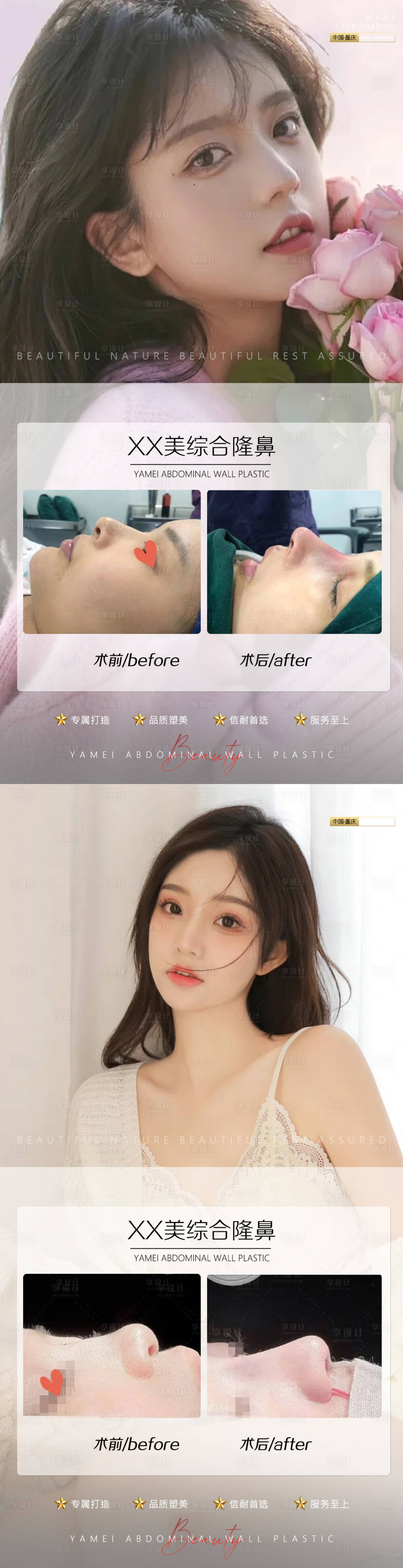 源文件下载【医美案例鼻子】编号：90140010906378869