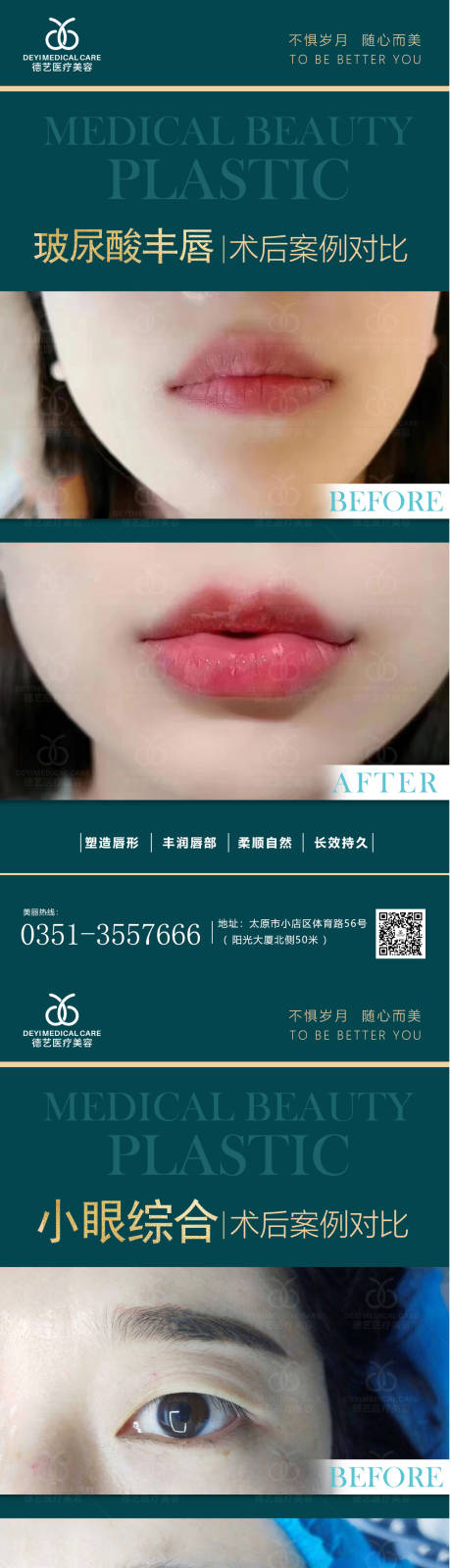 源文件下载【医美案例对比图】编号：51150011362605227