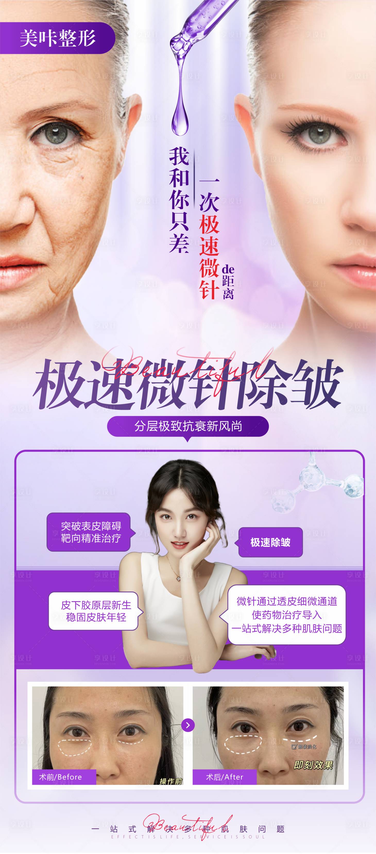 源文件下載【享設計】搜索編號：40870011085467357【除皺宣傳展架】