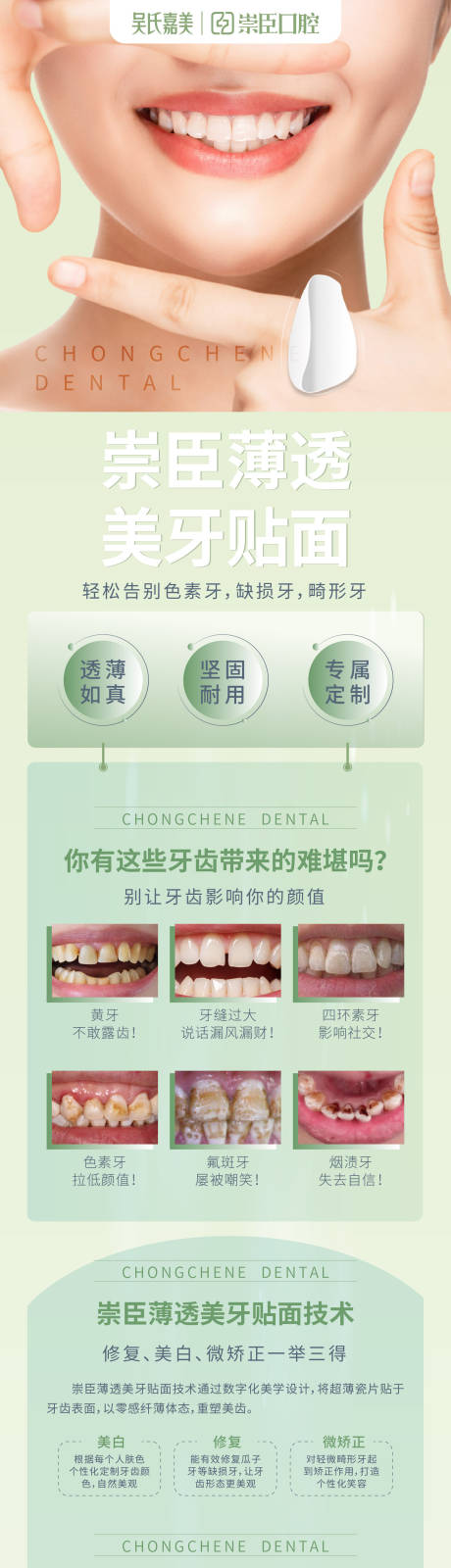 源文件下载【牙贴面详情页】编号：20220715172238990