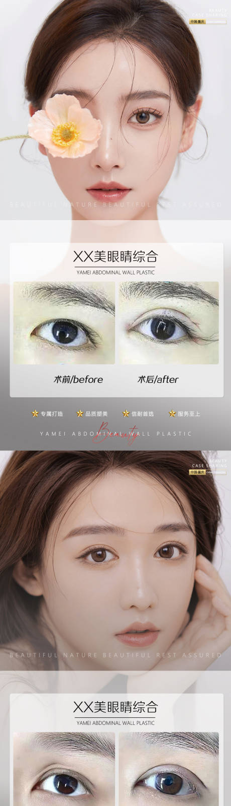 源文件下载【享设计】搜索编号：26480010948015259【医美案例眼睛系列海报】