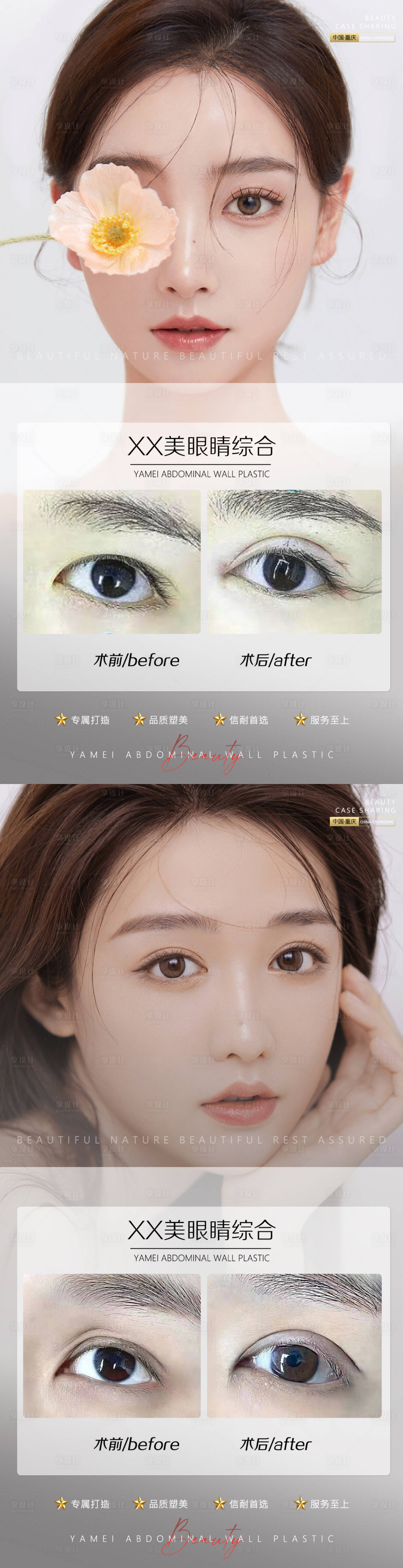 源文件下载【享设计】搜索编号：26480010948015259【医美案例眼睛系列海报】