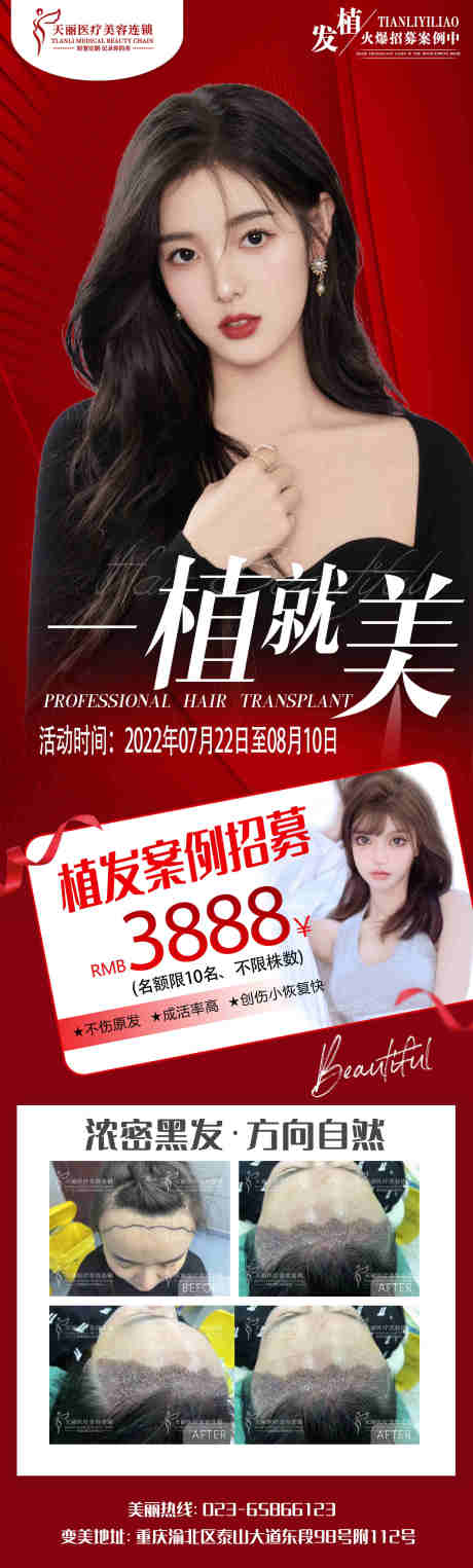 源文件下載【醫美植發招募海報】編號：95920011221377312