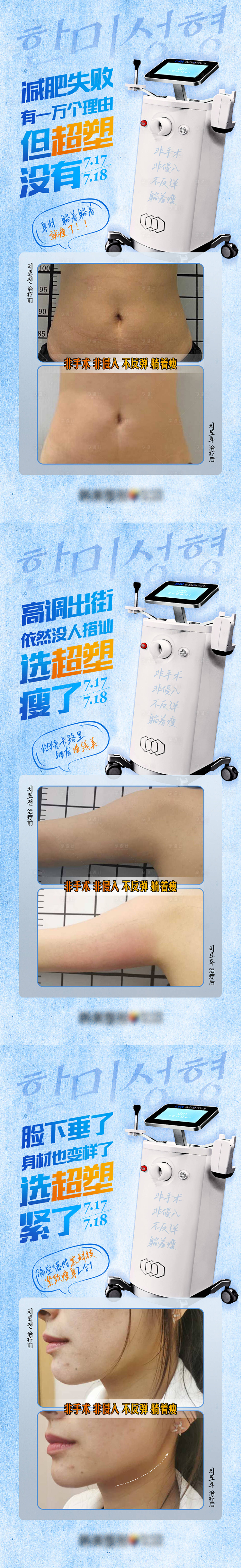 源文件下载【享设计】搜索编号：20500011367531577【医美整形减肥塑身紧致超塑案例套图】