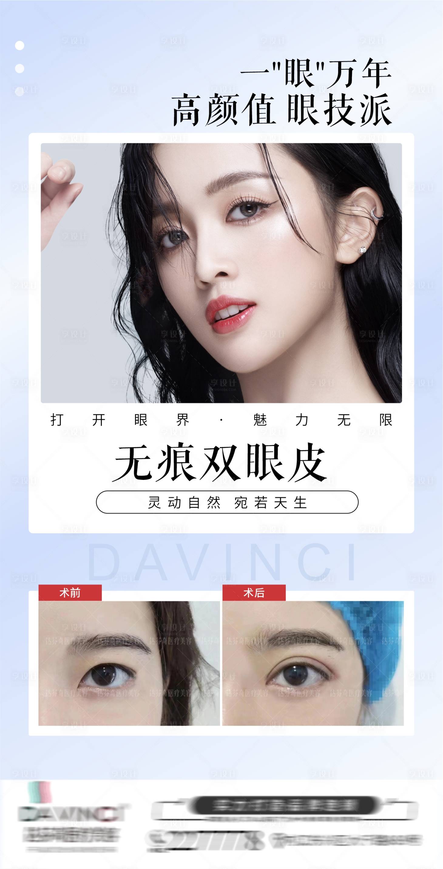源文件下载【双眼皮案例海报】编号：48750011185431952