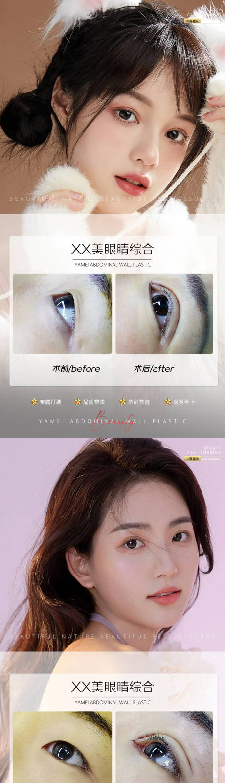源文件下载【医美案例眼睛海报】编号：47510011079589248