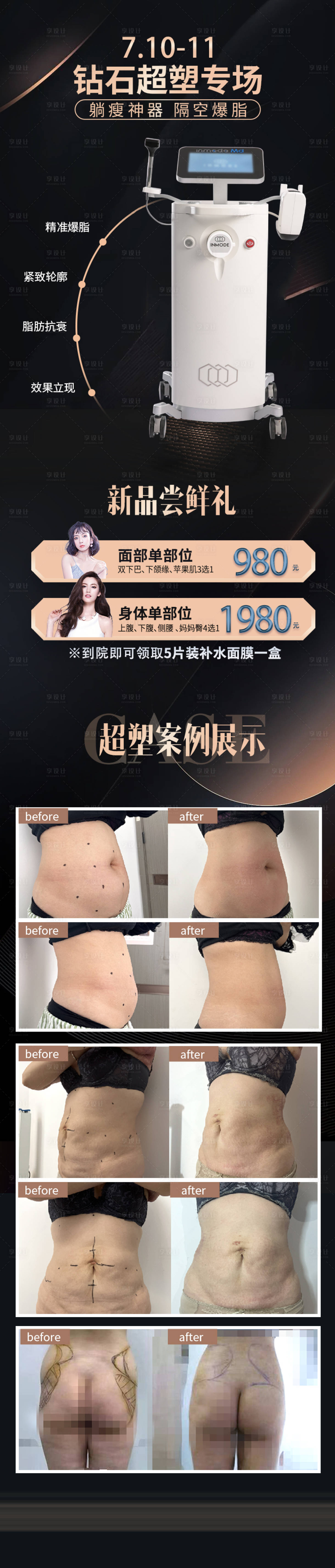 源文件下載【享設計】搜索編號：19000010917911290【鉆石超塑醫美海報】