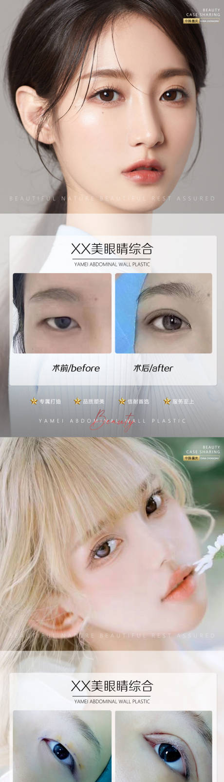 源文件下载【享设计】搜索编号：48700011100378849【医美案例眼睛系列海报】