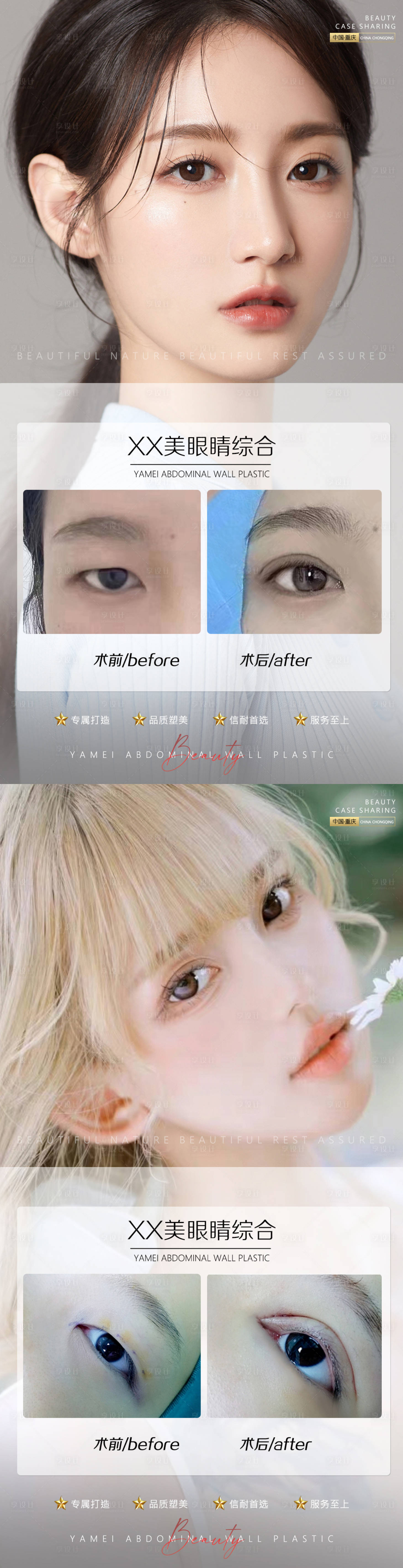 源文件下载【享设计】搜索编号：48700011100378849【医美案例眼睛系列海报】