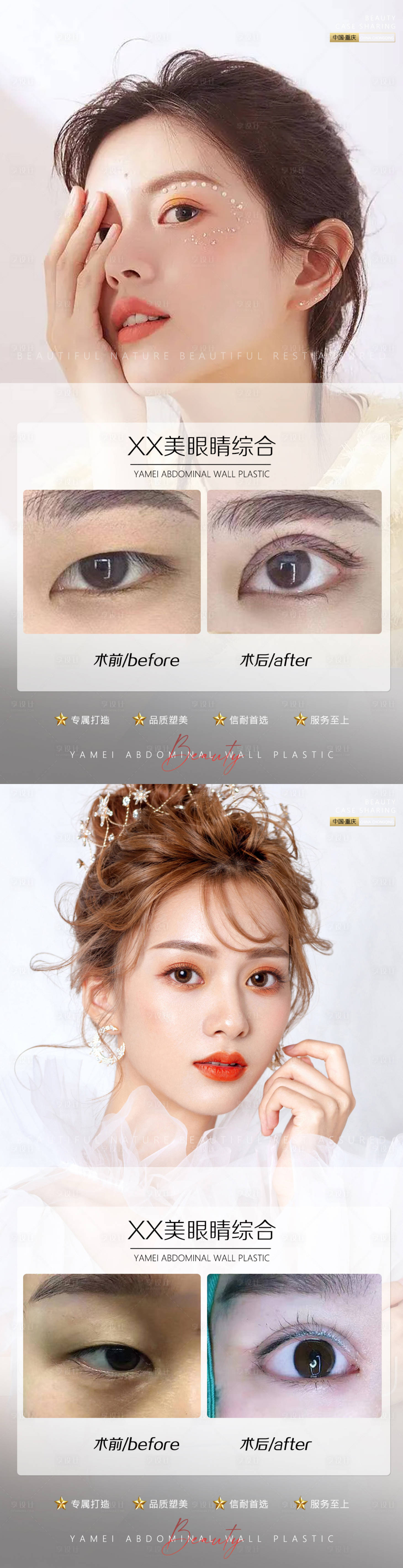 源文件下载【享设计】搜索编号：40670010880177691【医美案例眼睛系列海报】