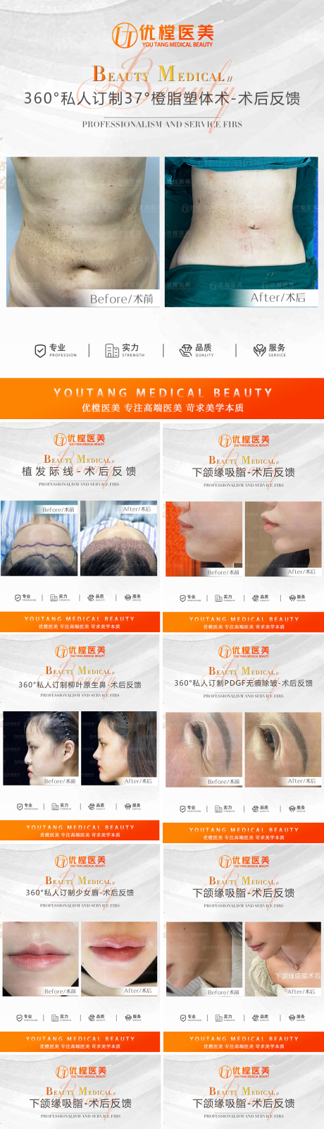 源文件下载【医美案例对比图系列海报】编号：74920011194431392
