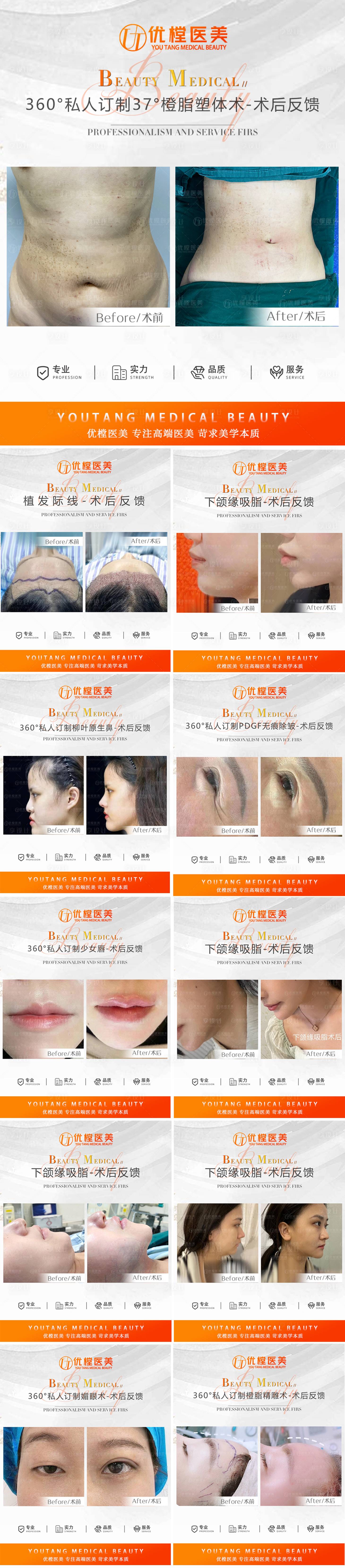 源文件下载【医美案例对比图系列海报】编号：74920011194431392