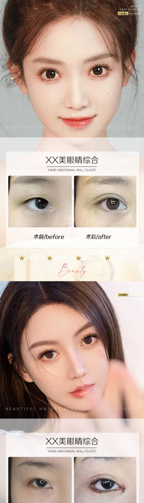 源文件下载【享设计】搜索编号：19970011366469428【医美案例眼睛系列海报】