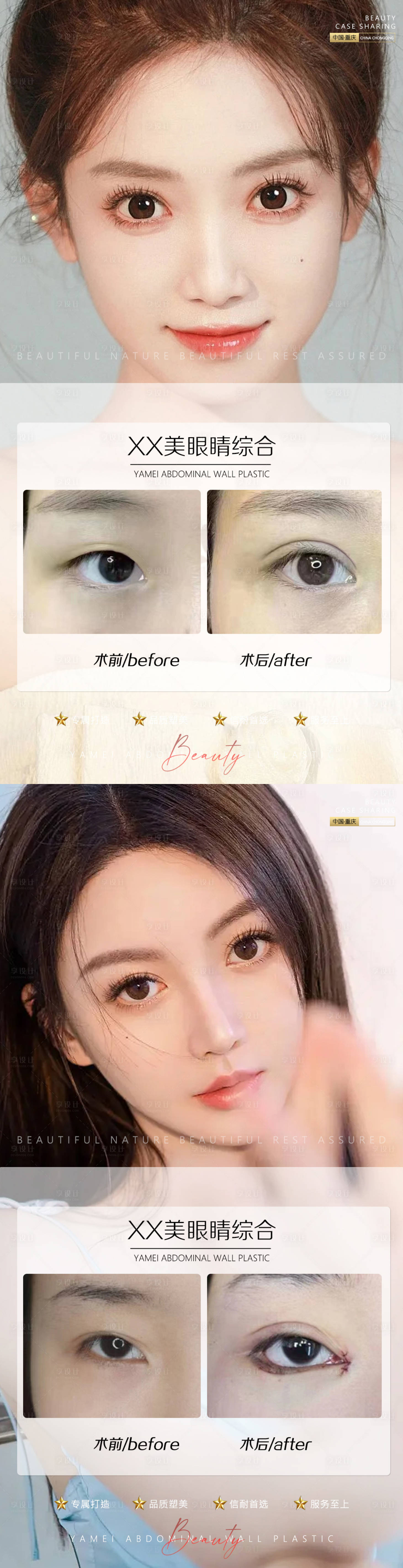 源文件下载【享设计】搜索编号：19970011366469428【医美案例眼睛系列海报】