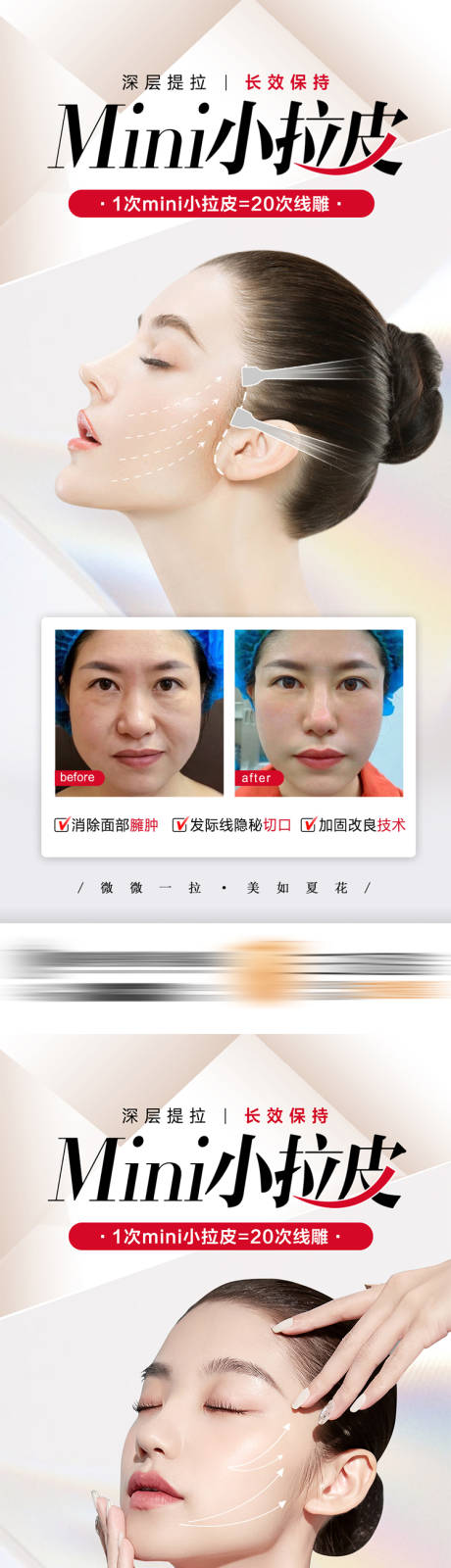 源文件下载【医美整形小拉皮抗衰】编号：20220723115913717