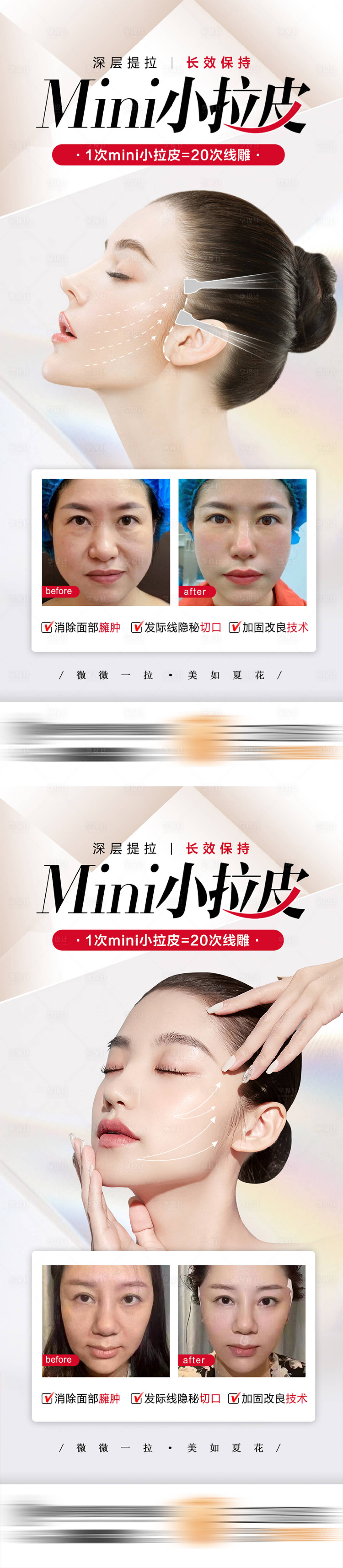 源文件下載【享設(shè)計(jì)】搜索編號(hào)：80030011236363754【醫(yī)美整形小拉皮抗衰】
