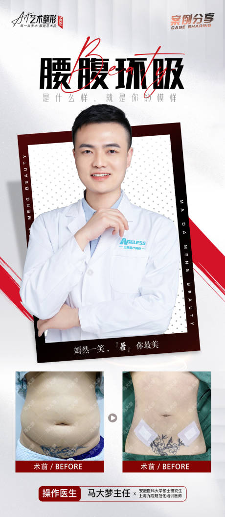 源文件下载【医美吸脂海报】编号：28940011361499814