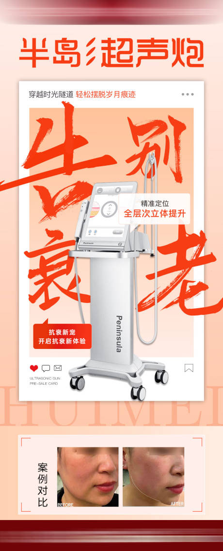 源文件下载【医美超声炮海报 】编号：47630011017225278