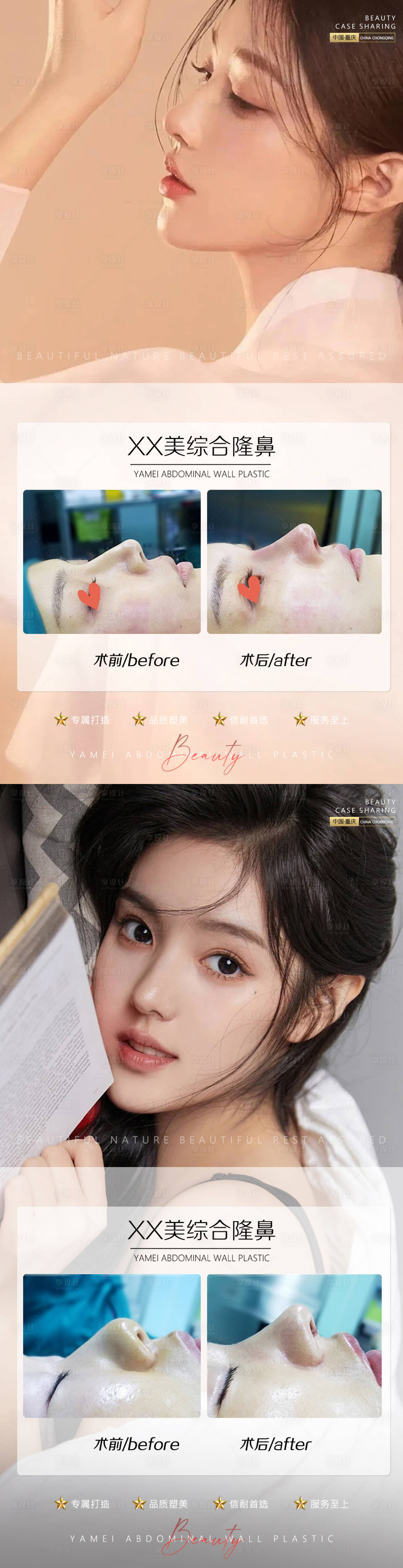 源文件下载【享设计】搜索编号：12150011096012594【医美案例鼻子】