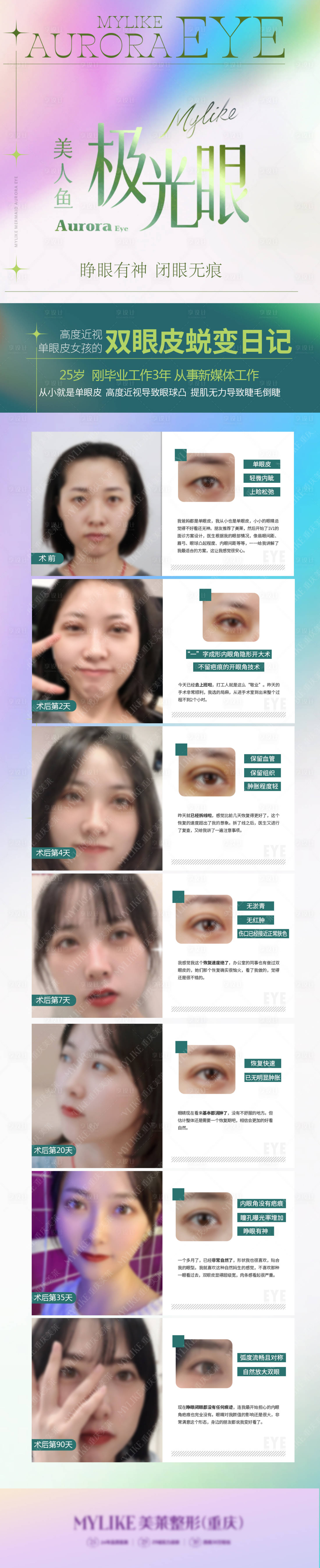 源文件下載【享設計】搜索編號：81890011095769712【雙眼皮案例對比】