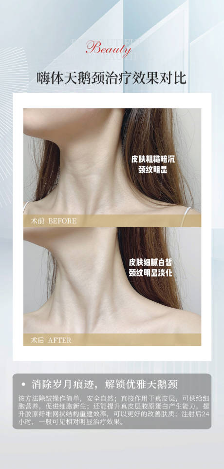 源文件下载【医美案例对比海报】编号：80730010862569146