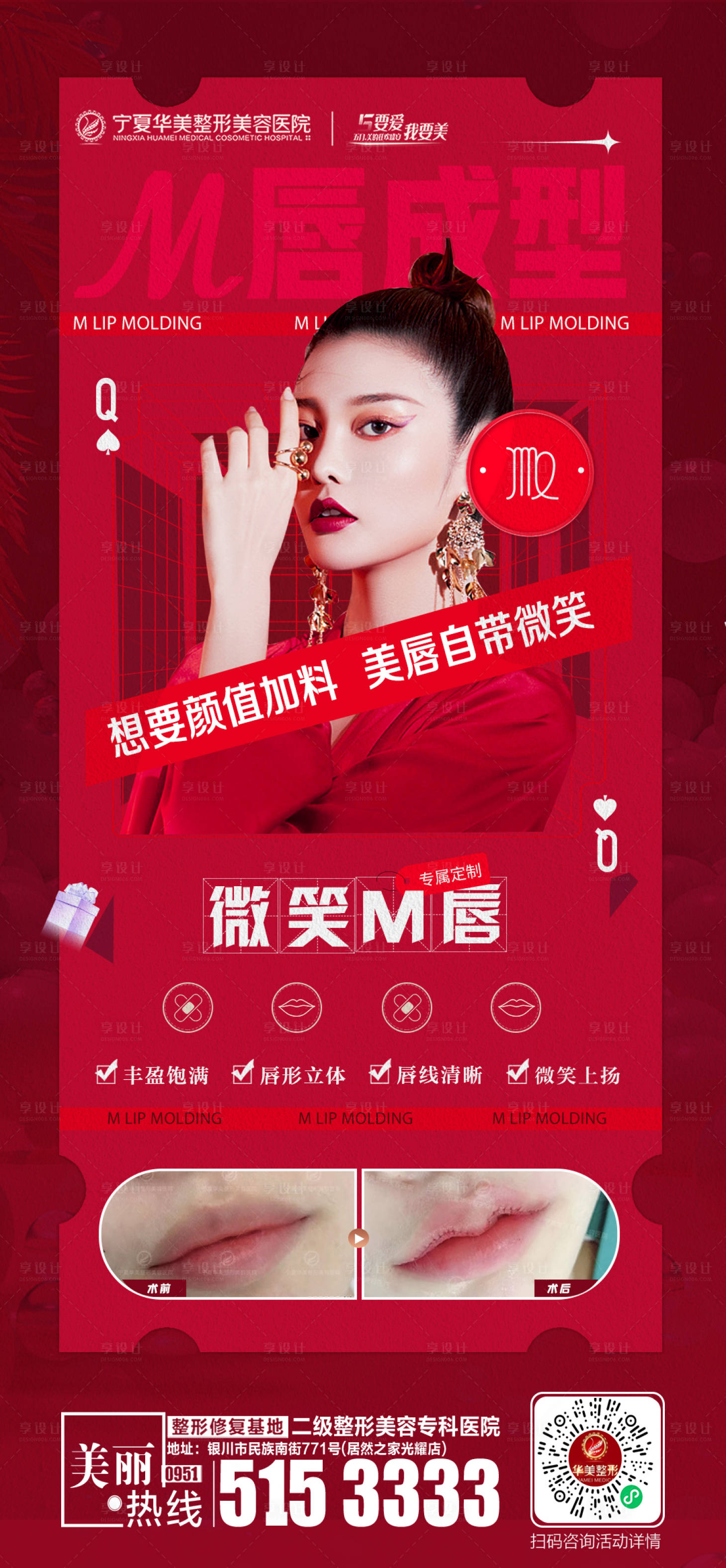 源文件下载【M唇成型】编号：47150011362404673