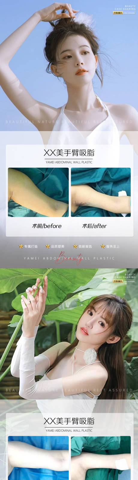源文件下载【医美案例手臂吸脂0702】编号：74530010849646077