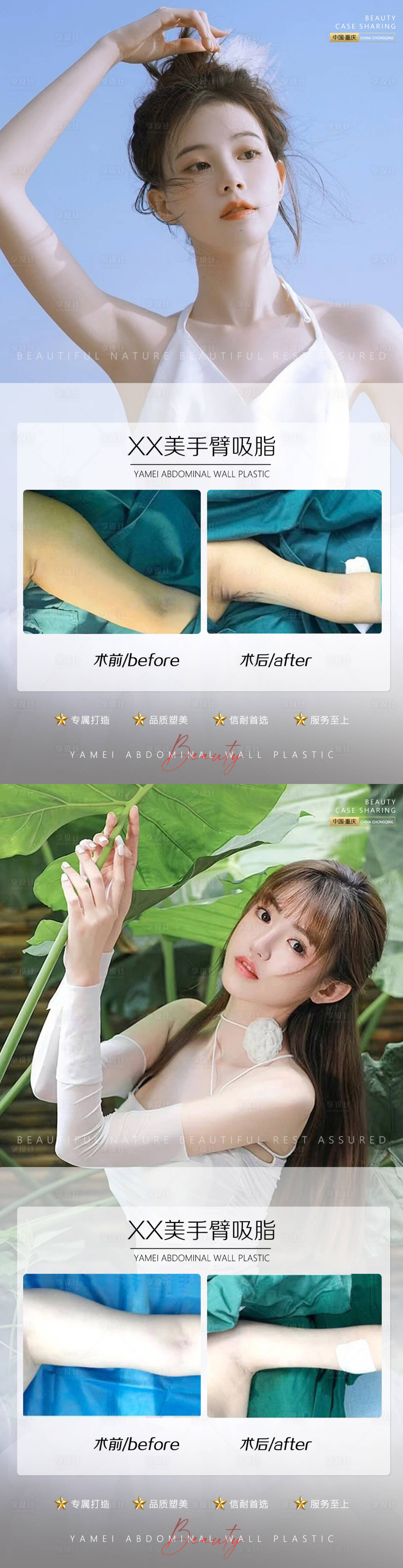 源文件下载【医美案例手臂吸脂0702】编号：74530010849646077