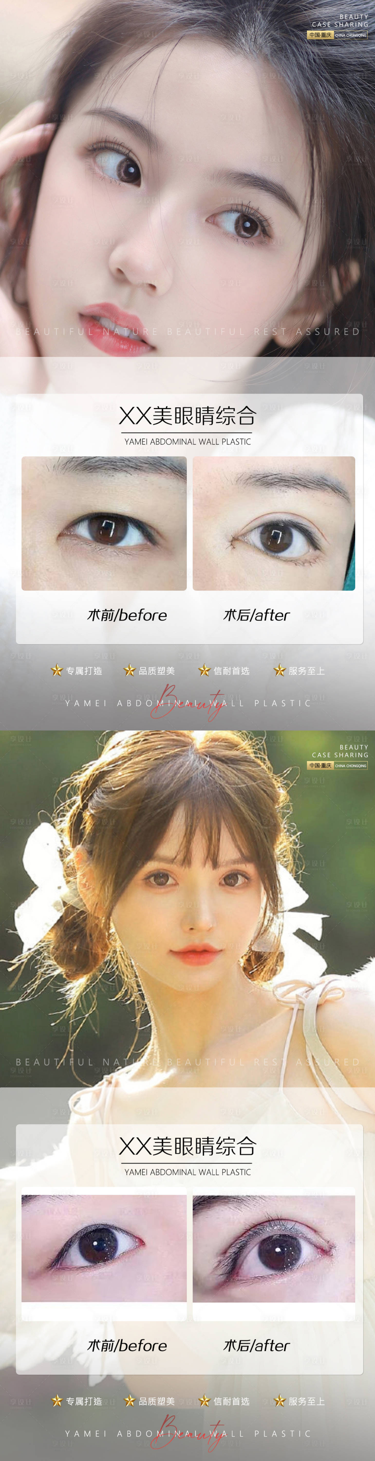 源文件下载【享设计】搜索编号：45540010904318674【医美案例眼睛系列海报】